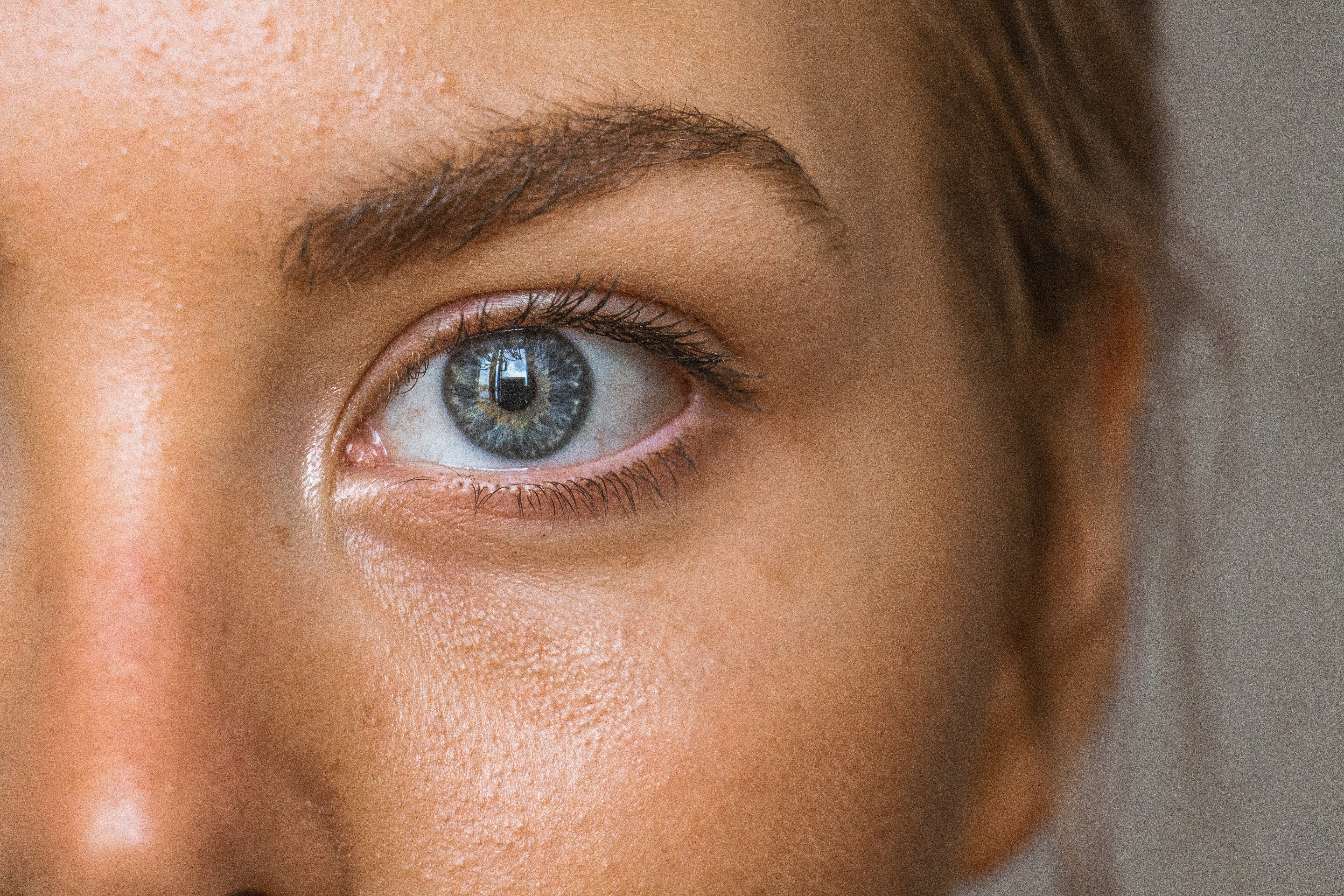 Brufoli sottopelle: Sconfiggi la Bumpy Skin