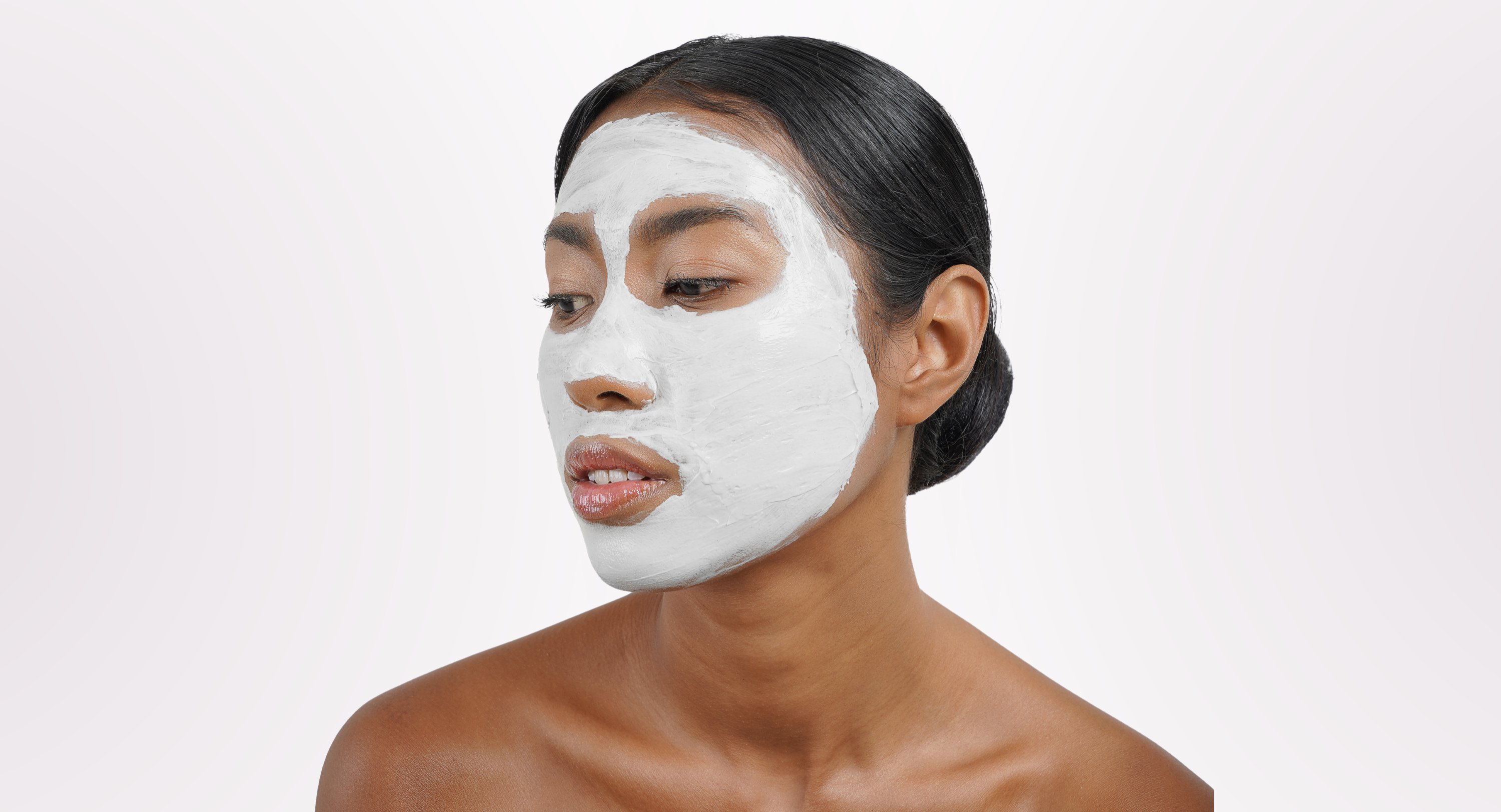 Rosacea